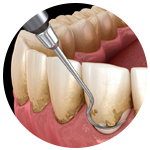 periodoncia