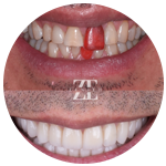 rehabilitación oral