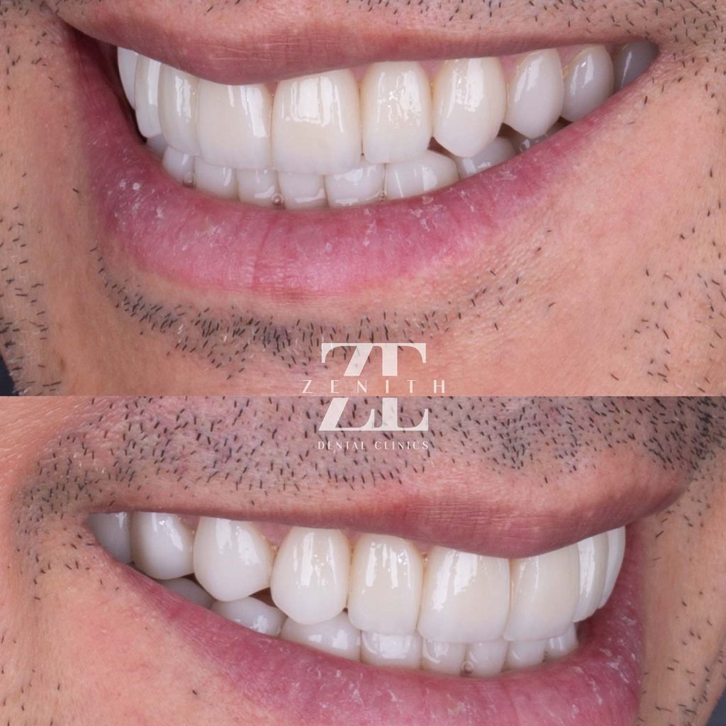 Clínica Odontológica Zenith