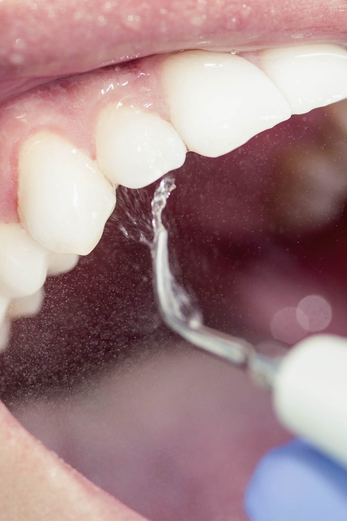 zenith periodoncia.jpg